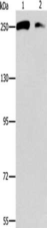 Gel: 6%SDS-PAGE, Lysate: 40 μg, Lane 1-2: Lovo cells, 293T cells, Primary antibody: EIF4G1 Antibody(EIF4G1 Antibody) at dilution 1/450, Secondary antibody: Goat anti rabbit IgG at 1/8000 dilution, Exposure time: 1 minuteRabbit anti-Human EIF4G1 Polyclonal Antibody
