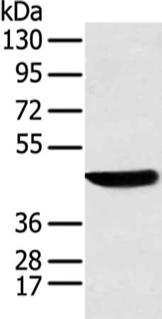 Gel: 8%SDS-PAGE, Lysate: 40 μg, Lane: K562 cell, Primary antibody: KRT18 Antibody(KRT18 Antibody) at dilution 1/200 dilution, Secondary antibody: Goat anti rabbit IgG at 1/8000 dilution, Exposure time: 5 seconds