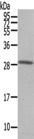 Gel: 12%SDS-PAGE,Lysate: 40 μg,,Primary antibody: OSM Antibody(OSM Antibody) at dilution 1/200 dilution,Secondary antibody: Goat anti rabbit IgG at 1/8000 dilution,Exposure time: 40 secondsRabbit anti-Human OSM Polyclonal Antibody