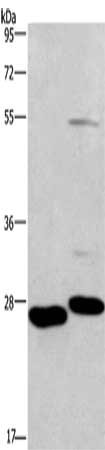 Gel: 8%SDS-PAGE, Lysate: 40 μg, Lane 1-2: Mouse intestinum tenue tissue, Mouse heart tissue, Primary antibody: CIDEC Antibody(CIDEC Antibody) at dilution 1/551, Secondary antibody: Goat anti rabbit IgG at 1/8000 dilution, Exposure time: 1 minuteRabbit anti-Human CIDEC Polyclonal Antibody