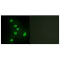 Immunofluorescence analysis of HepG2 cells, using NR2F6 antibody.Rabbit anti-Human NR2F6 Polyclonal Antibody