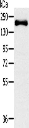 Gel: 6%SDS-PAGE, Lysate: 60 μg, Lane: Mouse bladder tissue, Primary antibody: SLIT2 Antibody(SLIT2 Antibody) at dilution 1/200, Secondary antibody: Goat anti rabbit IgG at 1/8000 dilution, Exposure time: 1 minuteRabbit anti-Human SLIT2 Polyclonal Antibody