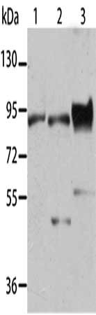 Gel: 8%SDS-PAGE, Lysate: 40 μg, Lane 1-3: Mouse muscle tissue, K562 cells, mouse heart tissue, Primary antibody: BAG3 Antibody(BAG3 Antibody) at dilution 1/450, Secondary antibody: Goat anti rabbit IgG at 1/8000 dilution, Exposure time: 10 seconds