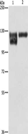 Gel: 6%SDS-PAGE, Lysate: 40 μg, Lane 1-2: A172 cells, human leiomyosarcoma tissue, Primary antibody: ITGB1 Antibody(ITGB1 Antibody) at dilution 1/600, Secondary antibody: Goat anti rabbit IgG at 1/8000 dilution, Exposure time: 40 seconds