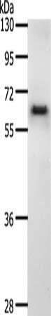 Gel: 10%SDS-PAGE, Lysate: 40 μg, Lane: K562 cells, Primary antibody: CDC6 Antibody(CDC6 Antibody) at dilution 1/200, Secondary antibody: Goat anti rabbit IgG at 1/8000 dilution, Exposure time: 2 minutesRabbit anti-Human CDC6 Polyclonal Antibody