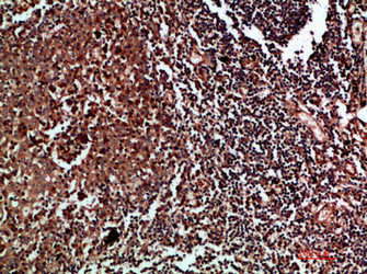 Immunohistochemical analysis of paraffin-embedded human-tonsil, antibody was diluted at 1:200Rabbit anti-Human CDK6 Polyclonal Antibody