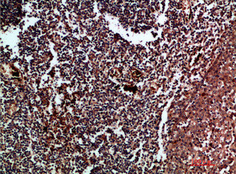 Immunohistochemical analysis of paraffin-embedded human-tonsil, antibody was diluted at 1:200Rabbit anti-Human CDK6 Polyclonal Antibody