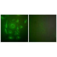 Immunofluorescence analysis of HepG2 cells, using Keratin 7 antibody.