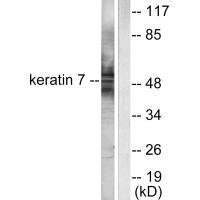 Western blot analysis of extracts from HepG2 cells, using Keratin 7 antibody.