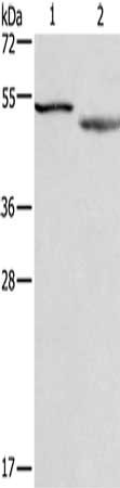 Gel: 10%SDS-PAGE, Lysate: 40 μg, Lane 1-2: RAW264.7 cells, mouse brain tissue, Primary antibody: CADM4 Antibody(CADM4 Antibody) at dilution 1/300, Secondary antibody: Goat anti rabbit IgG at 1/8000 dilution, Exposure time: 20 seconds