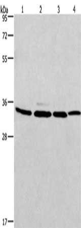 Gel: 10%SDS-PAGE, Lysate: 40 μg, Lane 1-4: A549 cells, 231 cells, PC3 cells, hela cells, Primary antibody: MAD2L1BP Antibody(MAD2L1BP Antibody) at dilution 1/675, Secondary antibody: Goat anti rabbit IgG at 1/8000 dilution, Exposure time: 20 seconds