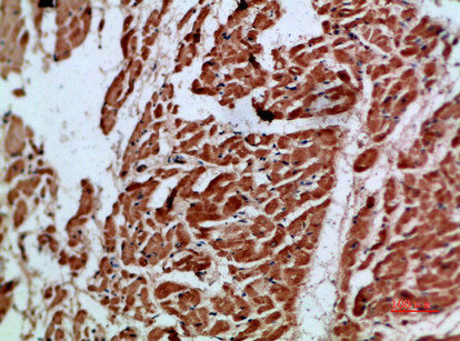 Immunohistochemical analysis of paraffin-embedded human-heart, antibody was diluted at 1:200Rabbit anti-Human ARTN Polyclonal Antibody