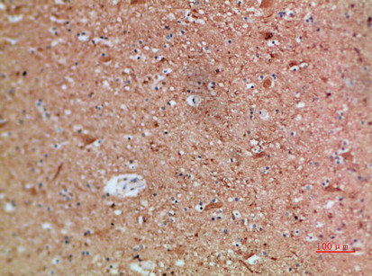 Immunohistochemical analysis of paraffin-embedded human-brain, antibody was diluted at 1:200Rabbit anti-Human ARTN Polyclonal Antibody