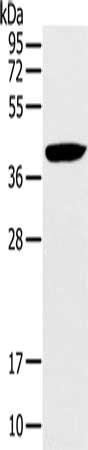 Gel: 10%SDS-PAGE, Lysate: 40 μg, Lane: Hela cells, Primary antibody: RAD51 Antibody(RAD51 Antibody) at dilution 1/200, Secondary antibody: Goat anti rabbit IgG at 1/8000 dilution, Exposure time: 20 secondsRabbit anti-Human RAD51 Polyclonal Antibody