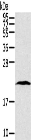 Gel: 12%SDS-PAGE, Lysate: 40 μg, Lane: Human lung cancer tissue, Primary antibody: TAF10 Antibody(TAF10 Antibody) at dilution 1/400, Secondary antibody: Goat anti rabbit IgG at 1/8000 dilution, Exposure time: 10 secondsRabbit anti-Human TAF10 Polyclonal Antibody