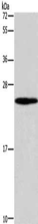 Gel: 10%SDS-PAGE, Lysate: 40 μg, Lane: 231 cells, Primary antibody: GUK1 Antibody(GUK1 Antibody) at dilution 1/400, Secondary antibody: Goat anti rabbit IgG at 1/8000 dilution, Exposure time: 1 minuteRabbit anti-Human GUK1 Polyclonal Antibody