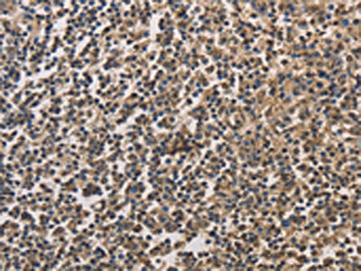 The image on the left is immunohistochemistry of paraffin-embedded Human tonsil tissue using the antibody Antibody) at dilution 1/20, on the right is treated with fusion protein. (Original magnification: ×200)Rabbit anti-Human DRG1 Polyclonal Antibody