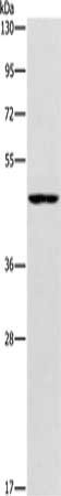 Gel: 8%SDS-PAGE, Lysate: 40 μg, Lane: Jurkat cells, Primary antibody: AMACR Antibody(AMACR Antibody) at dilution 1/350, Secondary antibody: Goat anti rabbit IgG at 1/8000 dilution, Exposure time: 20 secondsRabbit anti-Human AMACR Polyclonal Antibody