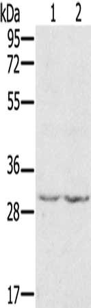 Gel: 8%SDS-PAGE, Lysate: 40 μg, Lane 1-2: 231 cells, A172 cells, Primary antibody: WDR83 Antibody(WDR83 Antibody) at dilution 1/300, Secondary antibody: Goat anti rabbit IgG at 1/8000 dilution, Exposure time: 5 minutesRabbit anti-Human WDR83 Polyclonal Antibody