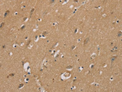 The image on the left is immunohistochemistry of paraffin-embedded Human brain tissue using the antibody Antibody) at dilution 1/40, on the right is treated with synthetic peptide. (Original magnification: ×200)Rabbit anti-Human RAD51 Polyclonal Antibody
