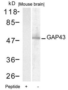 Western blot analysis of extracts from mouse brain tissue using GAP43(Ab-41) Antibody and the same antibody preincubated with blocking peptide.Rabbit anti-Human GAP43 Polyclonal Antibody