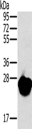 Gel: 10%SDS-PAGE, Lysate: 40 μg, Lane: Mouse heart tissue, Primary antibody: MYL3 Antibody(MYL3 Antibody) at dilution 1/650, Secondary antibody: Goat anti rabbit IgG at 1/8000 dilution, Exposure time: 10 secondsRabbit anti-Human MYL3 Polyclonal Antibody