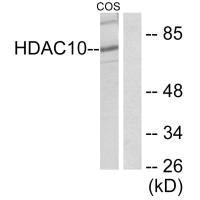 Western blot analysis of extracts from COS7 cells, using HDAC10 antibody.Rabbit anti-Human HDAC10 Polyclonal Antibody