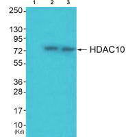 Western blot analysis of extracts from JK cells (Lane 2) and cos-7 cells (Lane 3), using HDAC10 antiobdy. The lane on the left is treated with synthesized peptide.Rabbit anti-Human HDAC10 Polyclonal Antibody