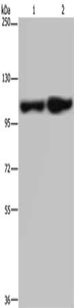 Gel: 6%SDS-PAGE, Lysate: 40 μg, Lane 1-2: Human fetal liver tissue, Human placenta tissue, Primary antibody: ITGA2B Antibody(ITGA2B Antibody) at dilution 1/200, Secondary antibody: Goat anti rabbit IgG at 1/8000 dilution, Exposure time: 3 minutes
