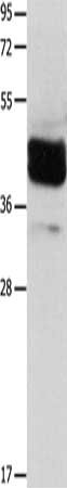 Gel: 12%SDS-PAGE, Lysate: 40 μg, Lane: Human brain malignant glioma tissue, Primary antibody: LRP1 Antibody(LRP1  Antibody) at dilution 1/650, Secondary antibody: Goat anti rabbit IgG at 1/8000 dilution, Exposure time: 40 seconds