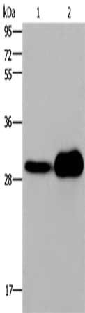 Gel: 10%SDS-PAGE, Lysate: 40 μg, Lane 1-2: Mouse kidney tissue, human fetal liver tissue, Primary antibody: KLRB1 Antibody(KLRB1 Antibody) at dilution 1/300, Secondary antibody: Goat anti rabbit IgG at 1/8000 dilution, Exposure time: 1 minute