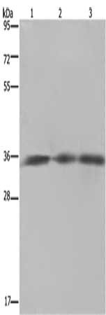 Gel: 8%SDS-PAGE, Lysate: 40 μg, Lane 1-3: SKOV3 cells, mouse heart tissue, Mouse brain tissue, Primary antibody: HMGCL Antibody(HMGCL Antibody) at dilution 1/150, Secondary antibody: Goat anti rabbit IgG at 1/8000 dilution, Exposure time: 5 secondsRabbit anti-Human HMGCL Polyclonal Antibody