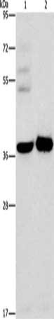 Gel: 8%SDS-PAGE, Lysate: 40 μg, Lane 1-2: A172 cells, human fetal brain tissue, Primary antibody: SERPINE2 Antibody(SERPINE2 Antibody) at dilution 1/450, Secondary antibody: Goat anti rabbit IgG at 1/8000 dilution, Exposure time: 15 secondsRabbit anti-Human SERPINE2 Polyclonal Antibody