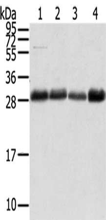 Gel: 12%SDS-PAGE,Lysate: 40 μg,Lane 1-4: A172 cells, 231 cells, Human normal stomach tissue, Hela cells,Primary antibody: TMED1 Antibody(TMED1 Antibody) at dilution 1/400 dilution,Secondary antibody: Goat anti rabbit IgG at 1/8000 dilution,Exposure time: 40 secondsRabbit anti-Human TMED1 Polyclonal Antibody