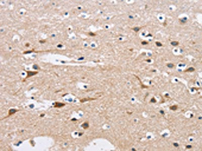 The image on the left is immunohistochemistry of paraffin-embedded Human brain  tissue using C3AR1 Antibody(C3AR1 Antibody) at dilution 1/50, on the right is treated with fusion protein. (Original magnification: x200)