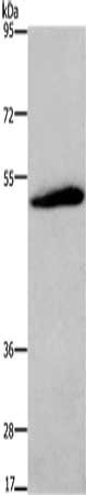 Gel: 6%SDS-PAGE, Lysate: 40 μg, Lane: Mouse brain tissue, Primary antibody: C3AR1 Antibody(C3AR1 Antibody) at dilution 1/200, Secondary antibody: Goat anti rabbit IgG at 1/8000 dilution, Exposure time: 10 minutes