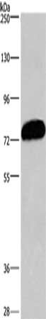 Gel: 6%SDS-PAGE, Lysate: 40 μg, Lane: PC3 cells, Primary antibody: CDCP1 Antibody(CDCP1 Antibody) at dilution 1/1100, Secondary antibody: Goat anti rabbit IgG at 1/8000 dilution, Exposure time: 30 secondsRabbit anti-Human CDCP1 Polyclonal Antibody