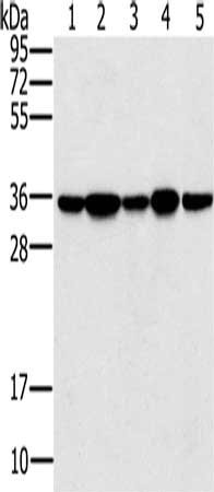 Gel: 10%SDS-PAGE, Lysate: 40 μg, Lane 1-5: Jurkat cells, 293T cells, hela cells, mouse brain tissue, K562 cells, Primary antibody: PPP1CC Antibody(PPP1CC Antibody) at dilution 1/200, Secondary antibody: Goat anti rabbit IgG at 1/8000 dilution, Exposure time: 1 secondRabbit anti-Human PPP1CC Polyclonal Antibody