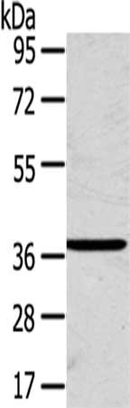 Gel: 8%SDS-PAGE,Lysate: 40 μg,,Primary antibody: SLC25A20 Antibody(SLC25A20 Antibody) at dilution 1/200 dilution,Secondary antibody: Goat anti rabbit IgG at 1/8000 dilution,Exposure time: 1 minuteRabbit anti-Human SLC25A20 Polyclonal Antibody