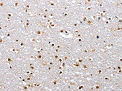 The image on the left is immunohistochemistry of paraffin-embedded Human brain  tissue using ELAVL1 Antibody(ELAVL1 Antibody) at dilution 1/40, on the right is treated with fusion protein. (Original magnification: ×200)Rabbit anti-Human ELAVL1 Polyclonal Antibody