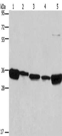 Gel: 10%SDS-PAGE, Lysate: 40 μg, Lane 1-5: 293T cells, A431 cells, NIH/3T3 cells, hela cells, hepG2 cells, Primary antibody: ELAVL1 Antibody(ELAVL1 Antibody) at dilution 1/667, Secondary antibody: Goat anti rabbit IgG at 1/8000 dilution, Exposure time: 5 secondsRabbit anti-Human ELAVL1 Polyclonal Antibody