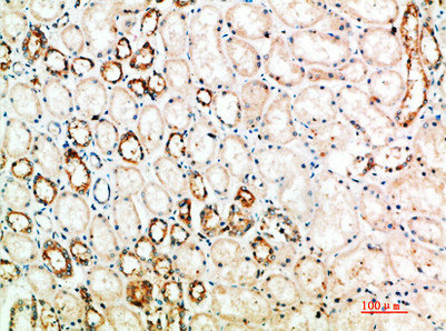 Immunohistochemical analysis of paraffin-embedded human-kidney, antibody was diluted at 1:200Rabbit anti-Human CTLA4 Polyclonal Antibody