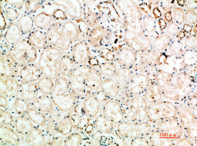 Immunohistochemical analysis of paraffin-embedded human-kidney, antibody was diluted at 1:200Rabbit anti-Human CTLA4 Polyclonal Antibody