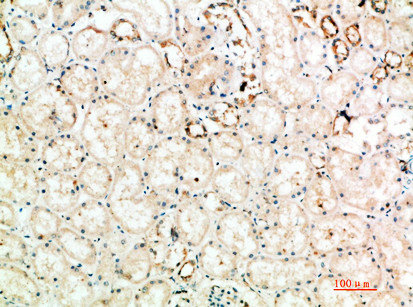 Immunohistochemical analysis of paraffin-embedded human-kidney, antibody was diluted at 1:200Rabbit anti-Human CTLA4 Polyclonal Antibody