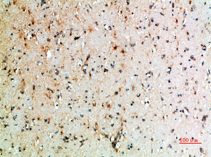 Immunohistochemical analysis of paraffin-embedded human-brain, antibody was diluted at 1:200Rabbit anti-Human CTLA4 Polyclonal Antibody