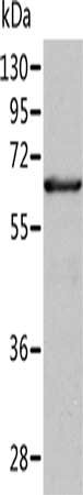 Gel: 10%SDS-PAGE, Lysate: 40 μg, Lane: Human fetal liver tissue, Primary antibody: ALDH4A1 Antibody(ALDH4A1 Antibody) at dilution 1/350, Secondary antibody: Goat anti rabbit IgG at 1/8000 dilution, Exposure time: 30 secondsRabbit anti-Human ALDH4A1 Polyclonal Antibody