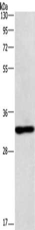 Gel: 8%SDS-PAGE, Lysate: 40 μg, Lane: mouse kidney tissue, Primary antibody: NAPSA Antibody(NAPSA Antibody) at dilution 1/500, Secondary antibody: Goat anti rabbit IgG at 1/8000 dilution, Exposure time: 1 minuteRabbit anti-Human NAPSA Polyclonal Antibody