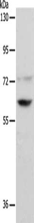 Gel: 8%SDS-PAGE, Lysate: 40 μg, Lane: K562 cells, Primary antibody: PSMD3 Antibody(PSMD3 Antibody) at dilution 1/300, Secondary antibody: Goat anti rabbit IgG at 1/8000 dilution, Exposure time: 5 secondsRabbit anti-Human PSMD3 Polyclonal Antibody