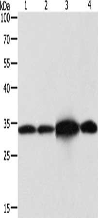 Gel: 12%SDS-PAGE, Lysate: 40 μg, Lane 1-4: Hela cells, Jurkat cells, mouse brain tissue, 293T cells, Primary antibody: NAPA Antibody(NAPA Antibody) at dilution 1/500, Secondary antibody: Goat anti rabbit IgG at 1/8000 dilution, Exposure time: 3 secondsRabbit anti-Human NAPA Polyclonal Antibody