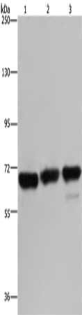 Gel: 6%SDS-PAGE, Lysate: 40 μg, Lane 1-3: 293T cells, Jurkat cells, Hela cells, Primary antibody: PCK2 Antibody(PCK2 Antibody) at dilution 1/750, Secondary antibody: Goat anti rabbit IgG at 1/8000 dilution, Exposure time: 10 minutesRabbit anti-Human PCK2 Polyclonal Antibody